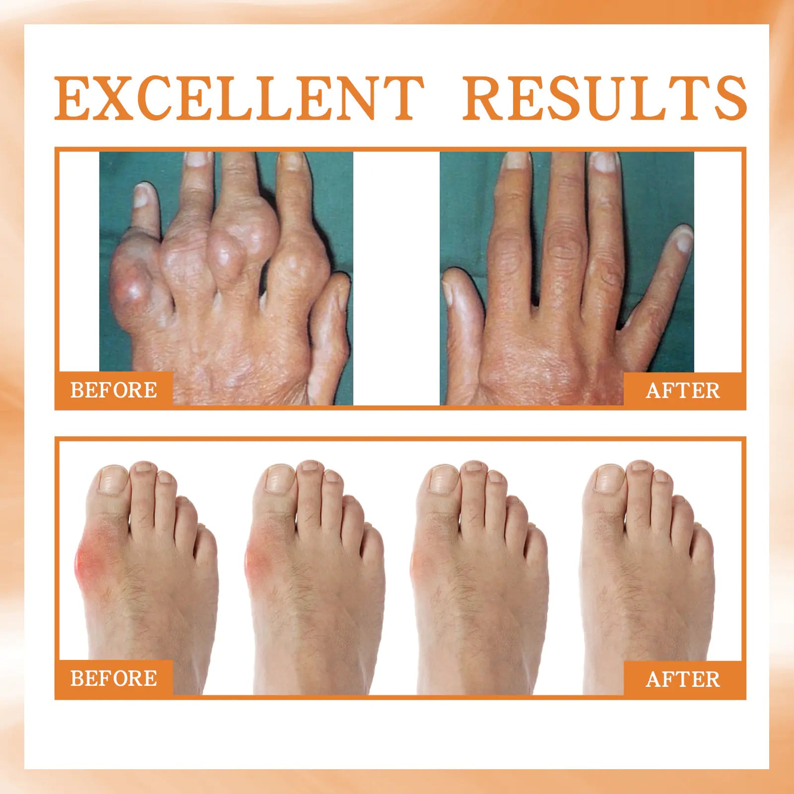 South Moon Joint Relief Spray for Pain and Care