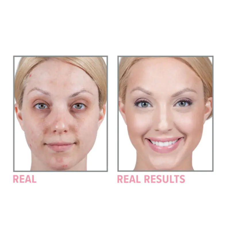 Super Moisturizing Anti-Wrinkle Cream