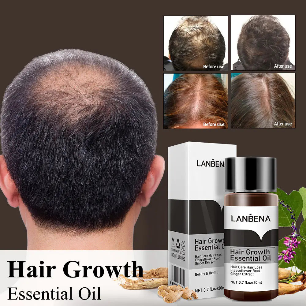 LANBENA Hair Growth Oil Treatment LA-25