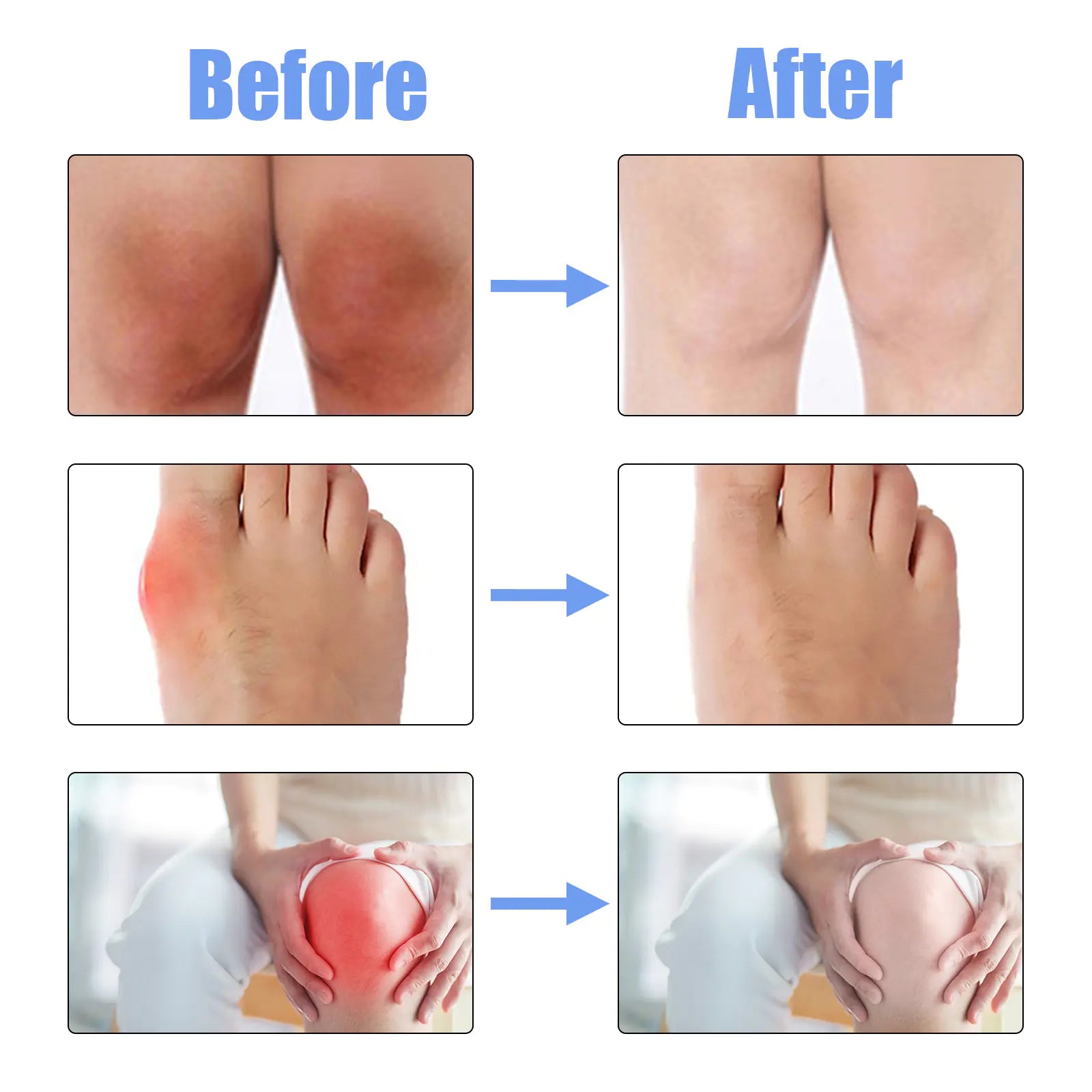 South Moon Joint Repair Spray for Pain Relief