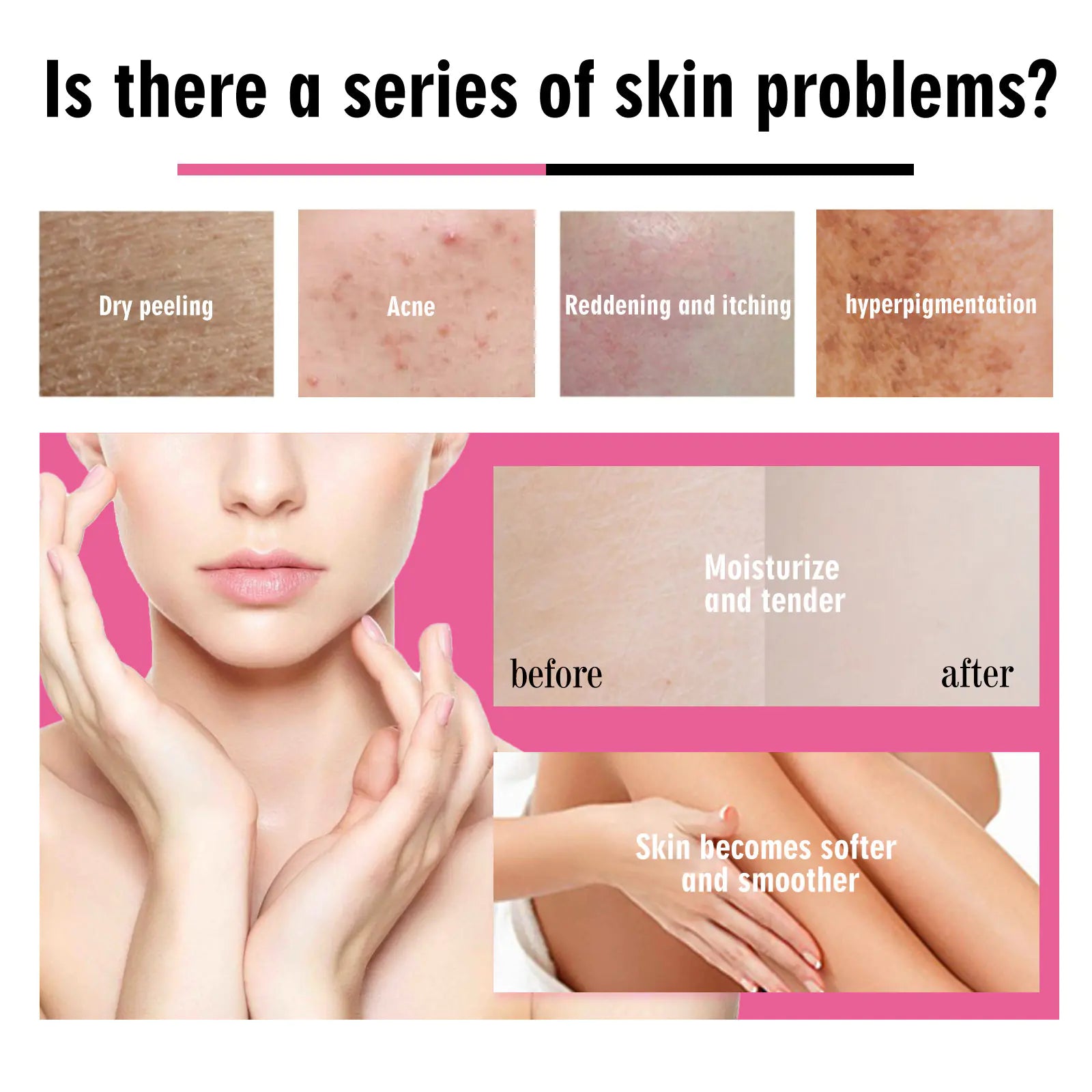 OUHOE Strawberry Essential Oil for Dry Skin Relief