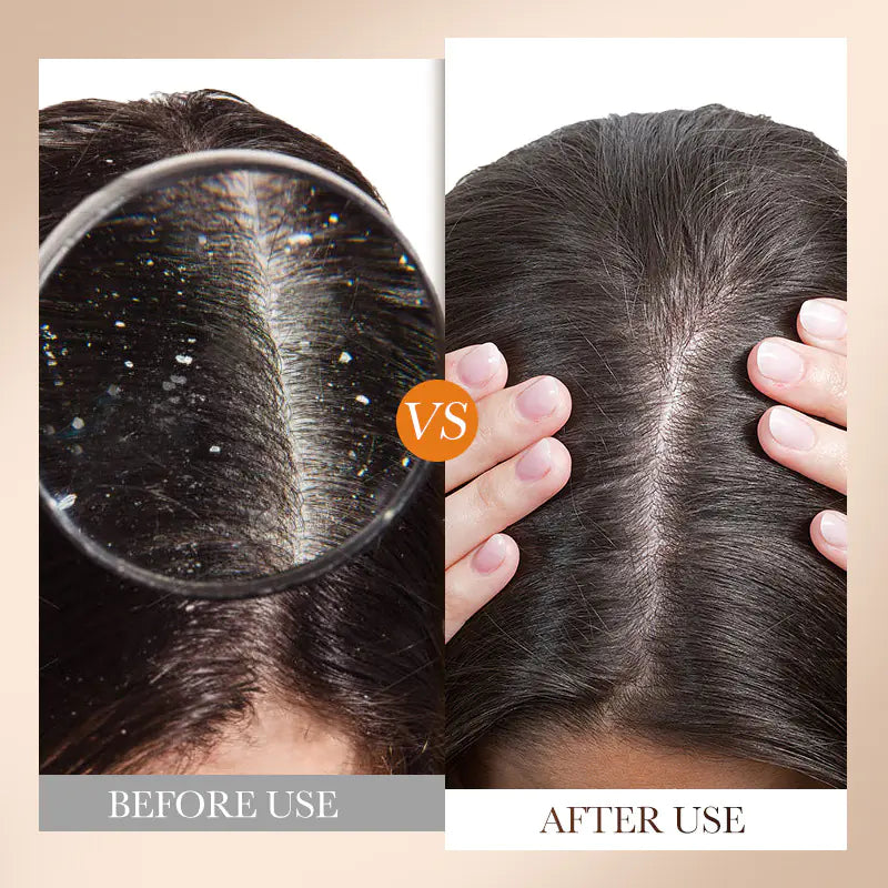 SADOER 500ml English Shampoo & Anti-Dandruff Conditioner