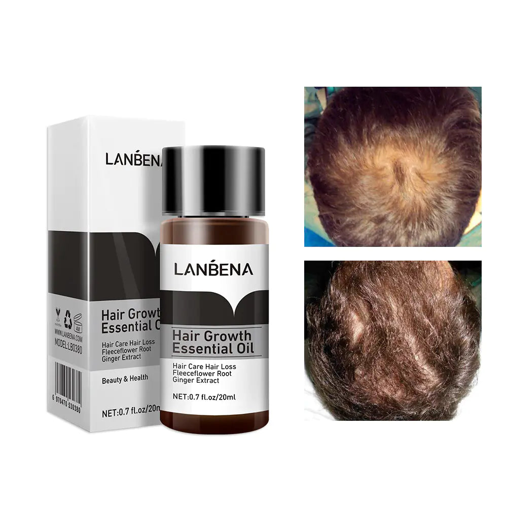 LANBENA Hair Growth Oil Treatment LA-25
